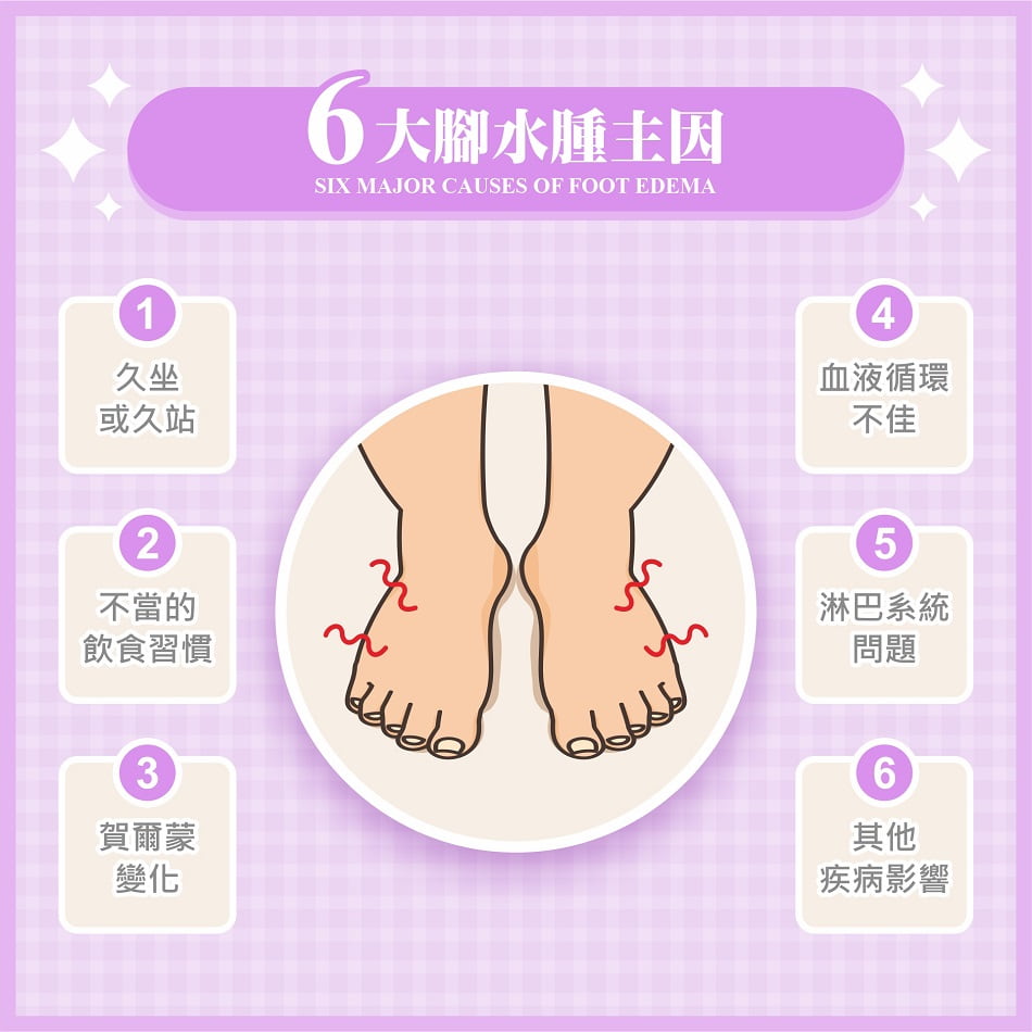 6大腳水腫主因