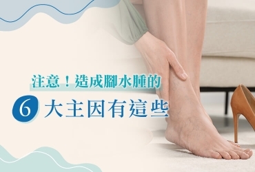 腳水腫原因有哪些？分析６大腳水腫原因，探索隱藏的健康警訊！