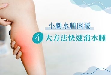 小腿水腫好困擾？小腿水腫原因、判斷方式，４方法快速消水腫！